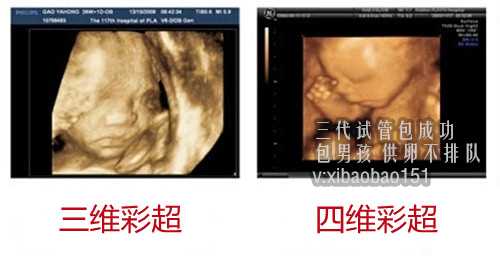 【上海代生公司比较】有关多囊卵巢做试管婴儿的好多个难题多囊卵巢做