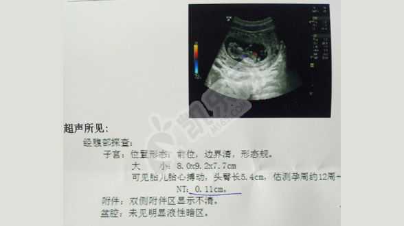 深圳合法代怀网,2采用济南第三代试管婴儿技术生娃多